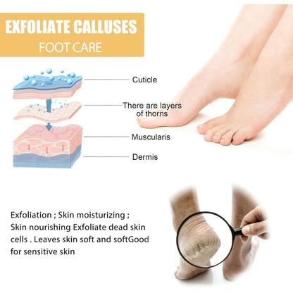 SmoothHeel™ Renewal Spray