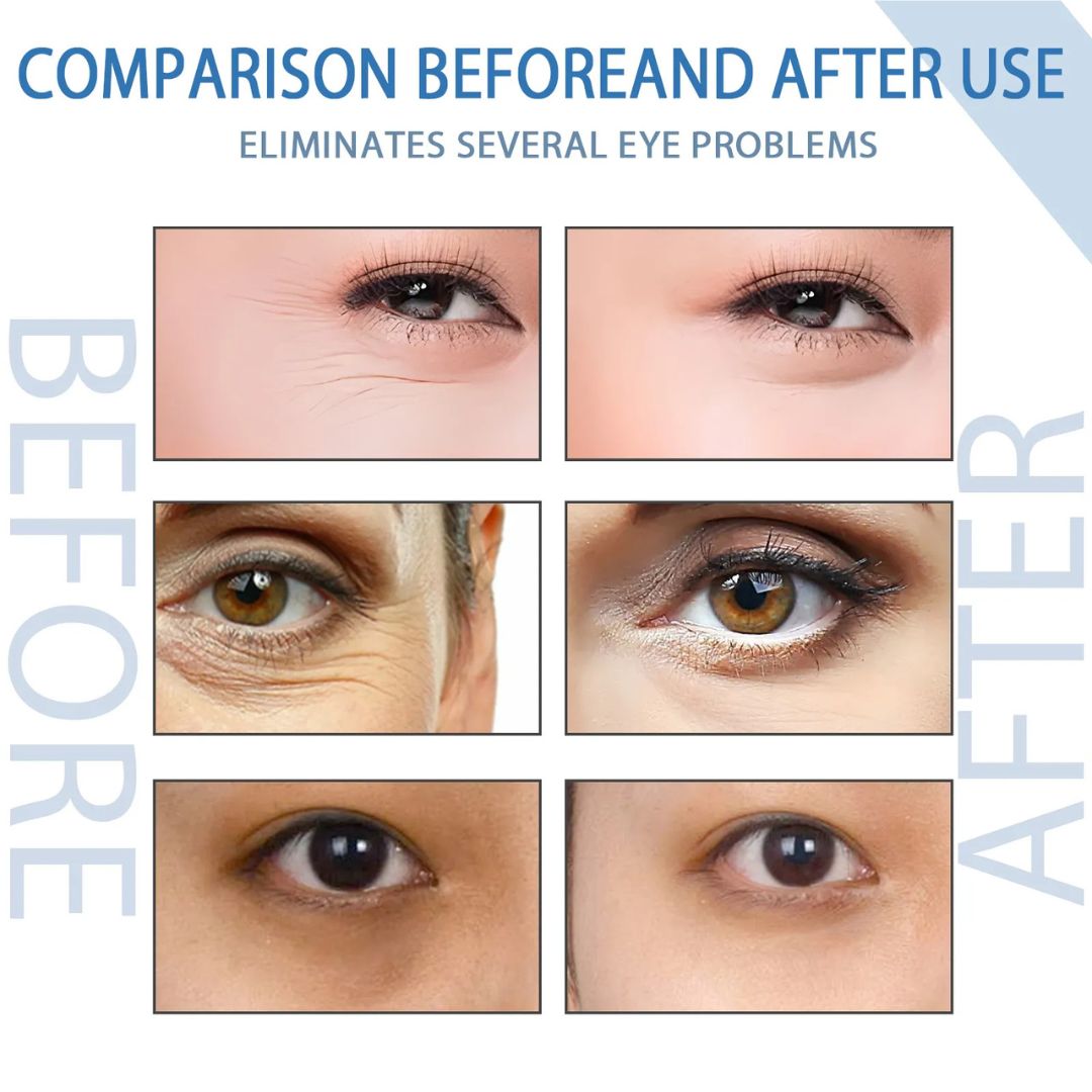 EyeCalm™ De-Puff Serum