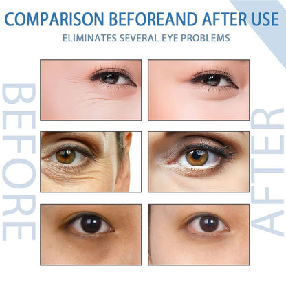 EyeCalm™ De-Puff Serum
