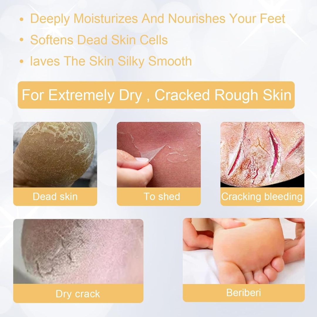 SmoothHeel™ Renewal Spray