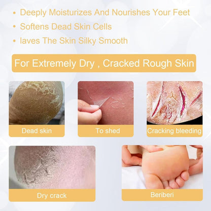 SmoothHeel™ Renewal Spray