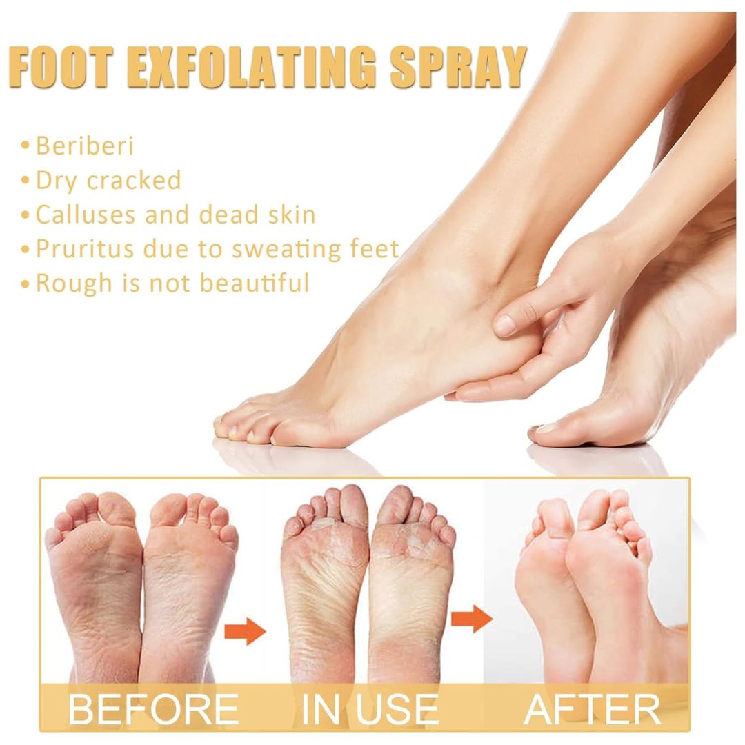 SmoothHeel™ Renewal Spray