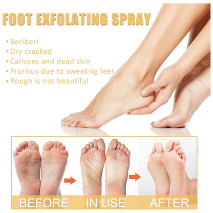 SmoothHeel™ Renewal Spray